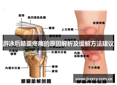 游泳后膝盖疼痛的原因解析及缓解方法建议